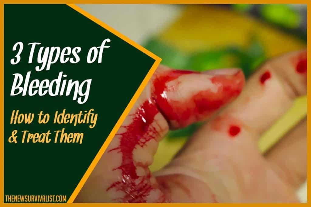 3 Types of Bleeding - How to Identify & Treat Them